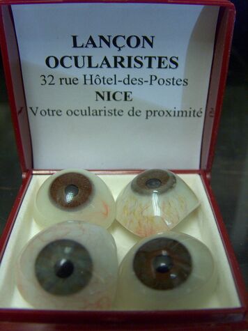 Actualité optique opticien : PROTHÈSE OCULAIRE