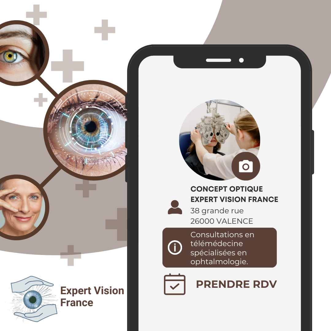 Image de l'actualité Partenaire Expert Vision France - Service d’accès à l’ophtalmologie